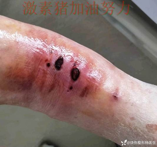 雄鹿防线告急球队隐患再次暴露